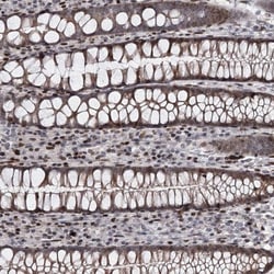 MDS028 Antibody, Novus Biologicals:Antibodies:Primary Antibodies
